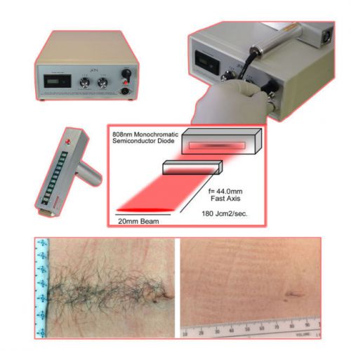 SDL80-DX Permanent Laser Hair Removal Device for Medispa &amp; Salon, best equipment