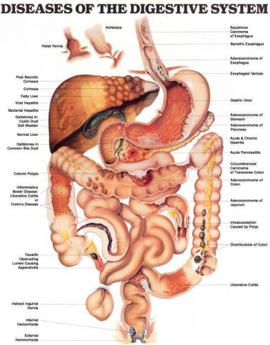 Diseases of the Digestive System * GI * Anatomy Poster * Anatomical Chart Comp.