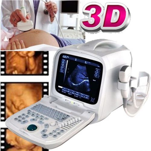 3d pc plateform full digital portable ultrasound scanner + 3.5 convex probe usb for sale