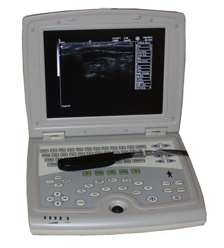 Amazing Veterinary Laptop ultrasound scanner LED 10&#034;&amp;rectal probe-USA warranty