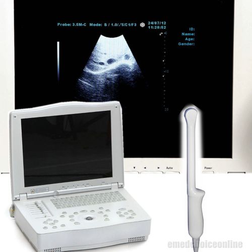Digital Laptop Ultrasound Scanner with transvaginal probe 80-element 3D software