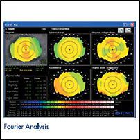 Tomey tms-4 corneal topographer new with 1 year warranty for sale