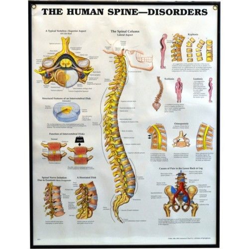 The Human Spine - Disorders * Anatomy Poster * Anatomical Chart Company