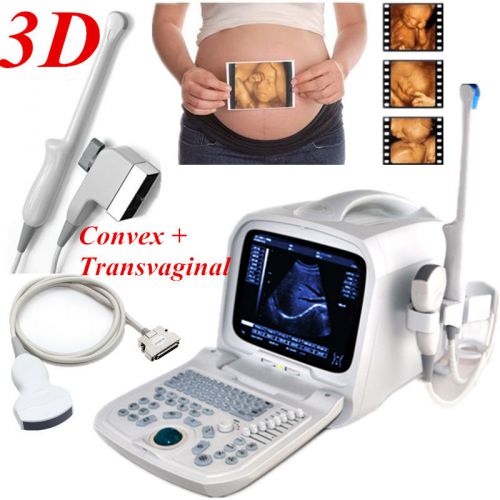 Internal 3d 3.5mhz convex+6.5mh transvaginal portable ultrasound scanner machine for sale