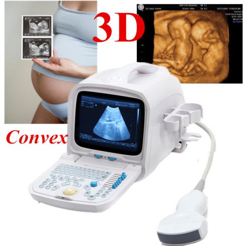 3d pc full digital portable ultrasound scanner machine 3.5mhz convex 3y warranty for sale