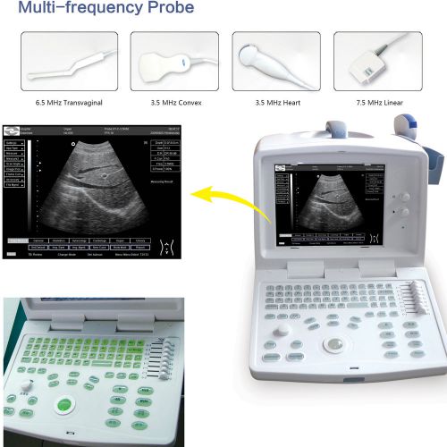 Full digital portable ultrasound scanner, ultrasound machine with convex probe for sale