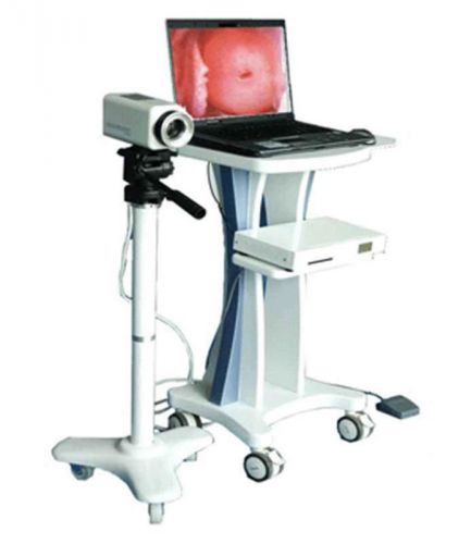 Ca digital electronic colposcope gynaecology vaginoscope sony camera + tripod aa for sale