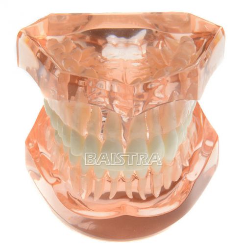 Dental ADULT TYPODONT Model UPPER AND LOWER JAW all teeth Removable transparent