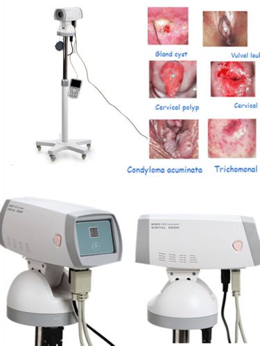 Digital electronic colposcope gynaecology gynae 800.000 pixels sony camera ce ca for sale