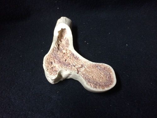 Femur Head Section Anatomical Bone Model