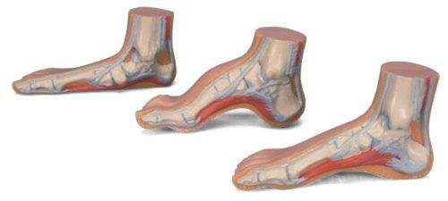 3B Scientific MEDart  Foot Series