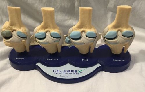 Celebrex Bone Model