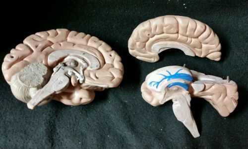 Vintage Human Brain Anatomical Model, 3 part (Missing Cerebellum. AS-IS)