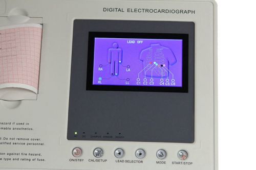 Digital 3-channel 4.3-inch color lcd electrocardiograph ecg/ekg machine for sale