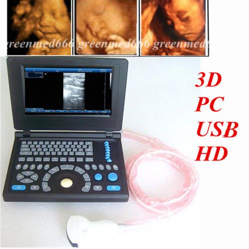 Pc platform notebook digital laptop ultrasound scanner hd  3d+7. 5 convex probes for sale