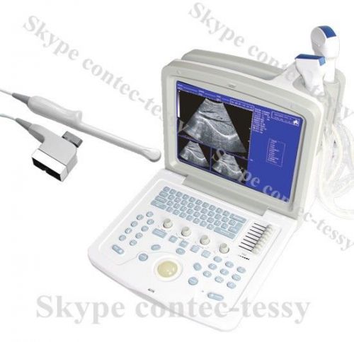 New Portable Ultrasound scanner 7.5Mhz Transvaginal Probe+3yrs warranty,CE 600B3