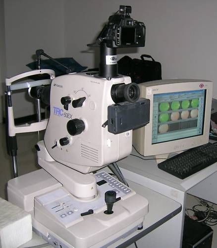 Topcon trc-50ex mydriatic retinal camera for sale