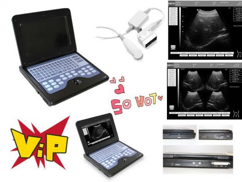 New laptop ultrasound diagnostic device,microconvex cardiac probe 5.0 for sale