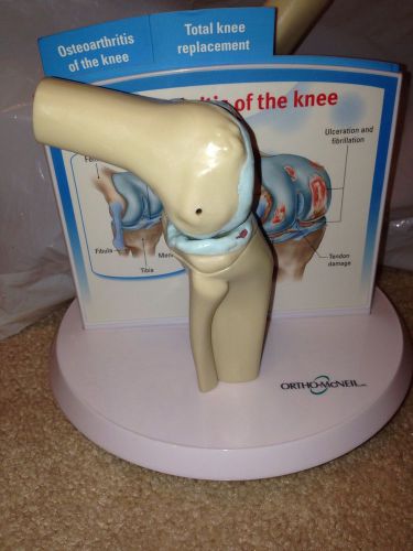 Ortho-McNeil Knee Model Osteoarthritis Knee Replacement Model Education Display