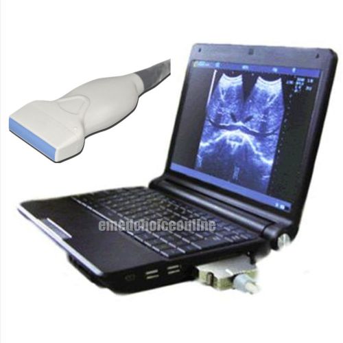 + 3d station full digital laptop ultrasound scanner + vga + 7.5mhz linear probe for sale