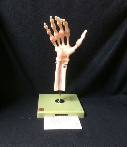Somso ns55 functional anatomical model of the hand &amp; finger joints (ns 55) for sale