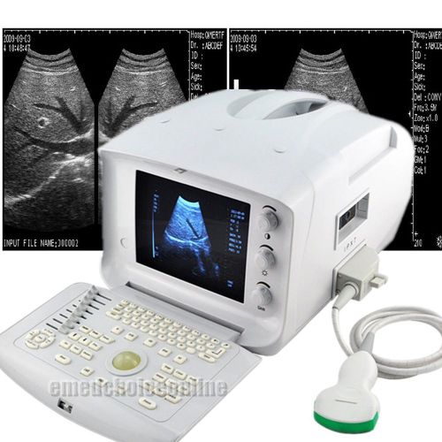 10inch new portable ultrasound scanner machine convex 2.0/3.5/4.5/5.0/5.5/7.5mhz for sale