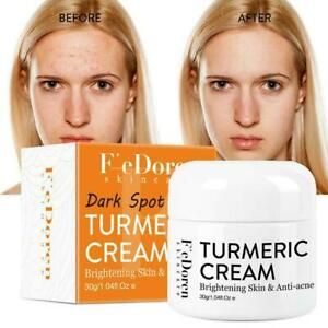 Vitamin C Brightening Hydrating Serum Moisturizing Cream O7B6