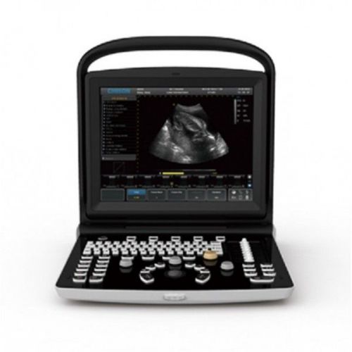 Chison ECO3 ultrasound