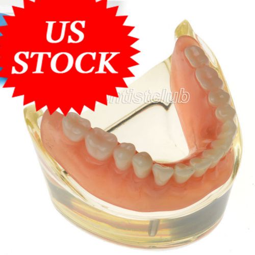 FAST Shipping Dental Miniature implant restoration teeth study teach mode# 6002