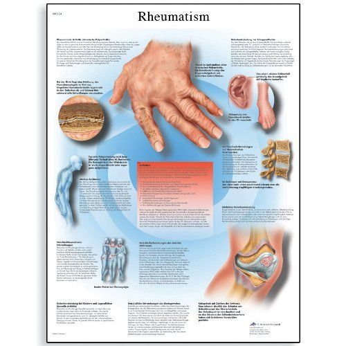 3B Scientific VR1124L Glossy Laminated Paper Rheumatic Diseases Anatomical Chart