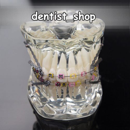 Transparent Dental Ortho Teeth Model w/ half metal half ceramic Brackets