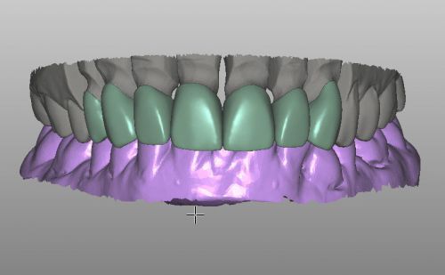 Dental lab cad design work , free design your test case.specialize in cad/cam. for sale