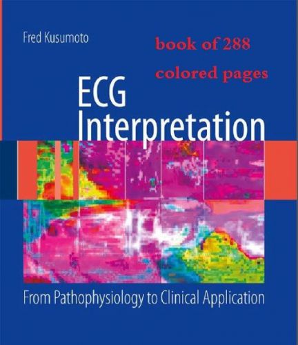 understand ECG e books