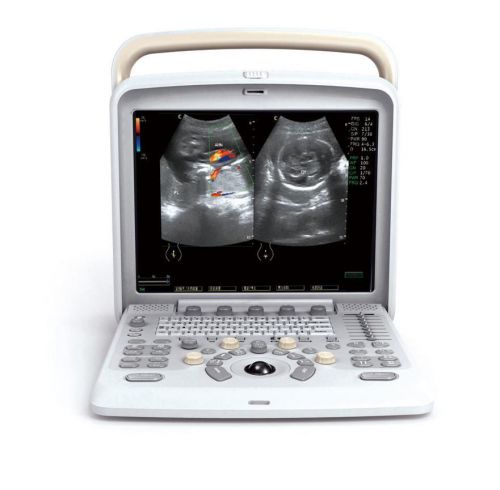 Chison Q5 ultrasound