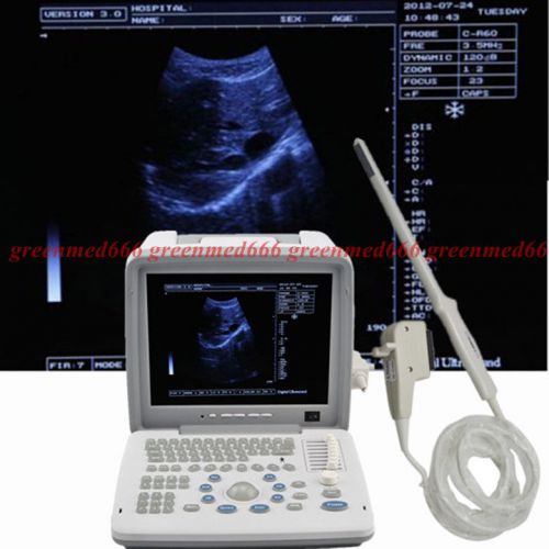 12.1 inch full digital portable ultrasound scanner+transvaginal probe 3d ce fda for sale