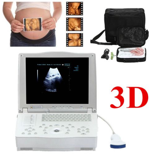 15 inch external 3d+ portable digital laptop ultrasound scanner machine convex for sale