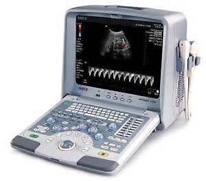 SIUI Apogee 1100 portable ultrasound machine