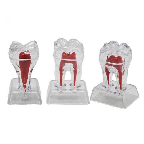 1 Teeth Dental Crystal Base Hard Plastic Teeth Tooth Molar Model teaching&amp;Study