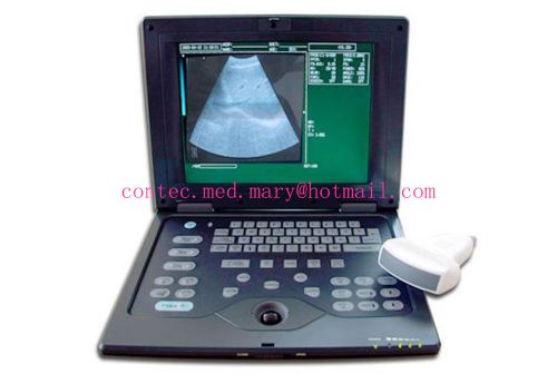 B-ultrasound scanner cms600p with 3.5mhz convex probe,10.4&#034;tft color lcd display for sale