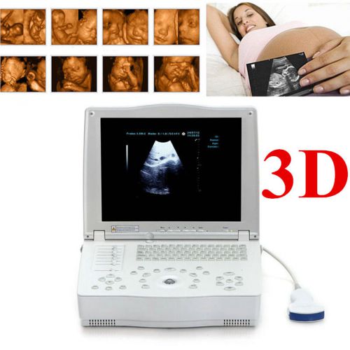 Ce 15 inch 3d+ portable digital laptop ultrasound scanner machine convex probe for sale