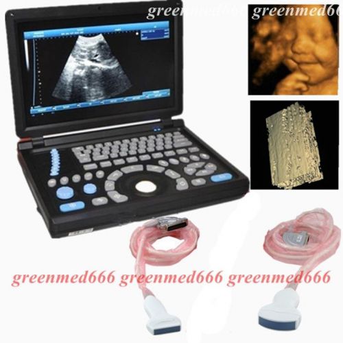 Ce hd pc mornitor 3d full digital laptop ultrasound scanner+ linear+convex probe for sale