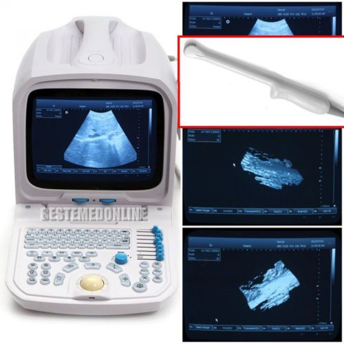 CE+FDA PC platform Built_in 3D Ultrasound Machine Scanner+6.5MHz Transvaginal ca