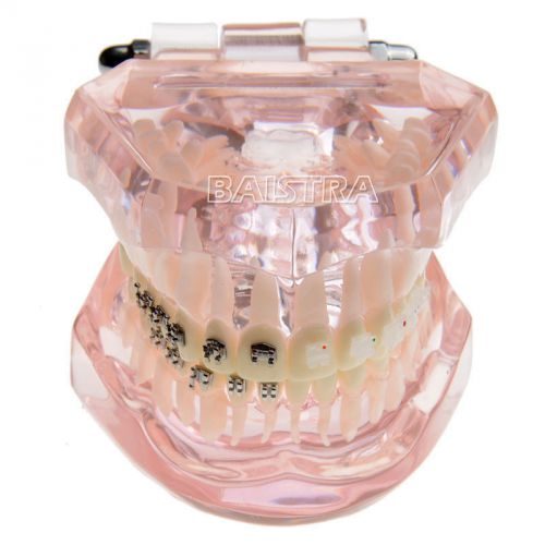 Dental Orthodontic bracket brace Teeth model 3009 contrast metal ceramic lingual