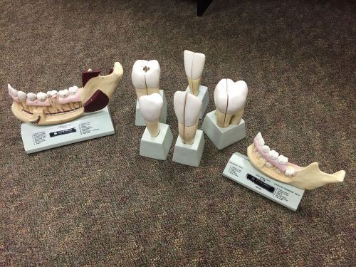 Nystrom Dental Teeth Model Set - Jaw, Teeth, Cavities, Teaching Tools Dentist