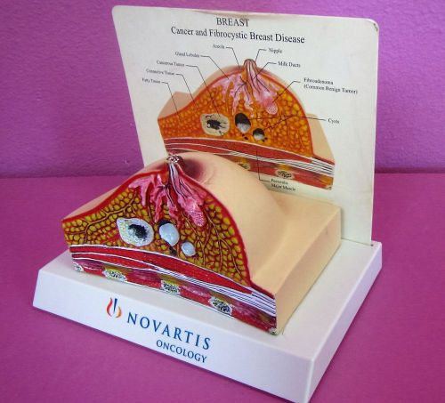 Anatomical Breast Model Desktop Anatomy Display for Cancer Fibrocystic Disease