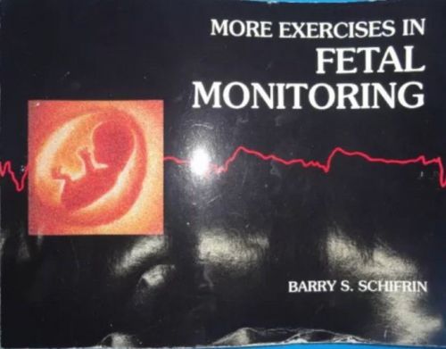 More Exercises in Fetal Monitoring by Schifrin, Barry S