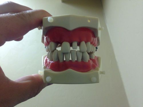 Columbia R862 Dental Crown Bridge Endo Tooth 9 Model Nerb Dentoform