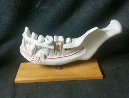 Antique Plaster Cenco Anatomical Model Human Teeth &amp; Jaw Mandible