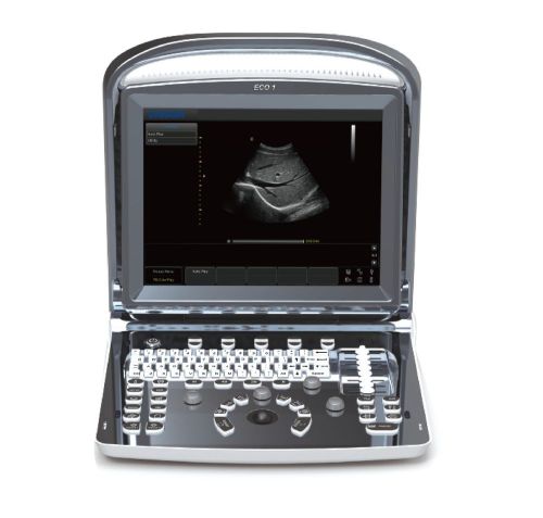 Chison eco1 portable ultrasound machine fda approved&amp;linear array 5-10mhz-deal for sale