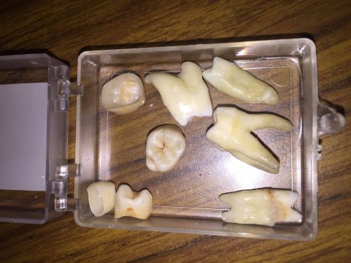 4 CROWN MOLARS AND 4 STUDY MODEL MOLORS ((make an offer)))